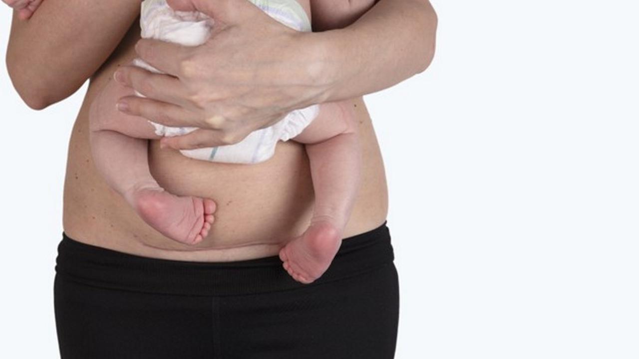 Женщина с животом после родов и ребенком на руках